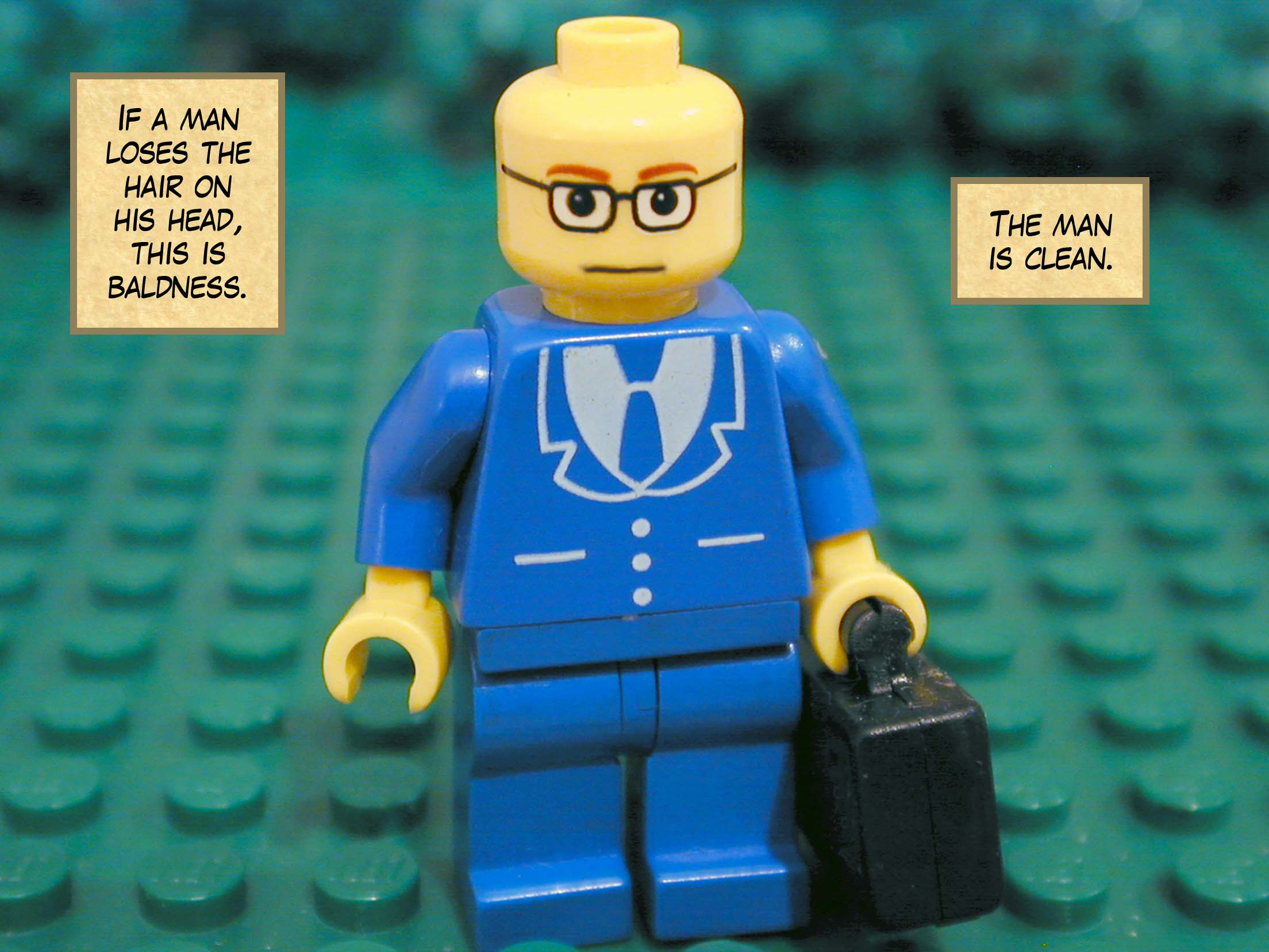 'If a man loses the hair on his head, this is baldness. The man is clean.'